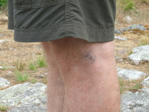 Appalachian Trail Bruse Appalachian Trail Bruse